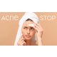 Sinoz - Acne Stop! -  Zsíros, Aknésodásra Hajlamos Bőr Elleni Szett